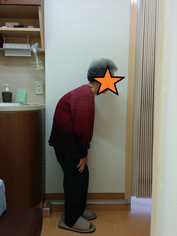 患者さん施術前